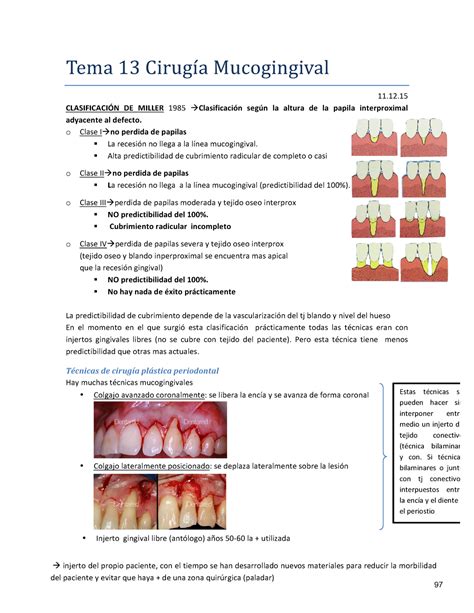 Tema 13 cirugia muco gingival 11 12 15 Tema 13 Cirugıa Mucogingival