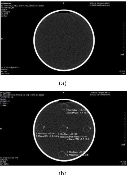 Penentuan Nilai Noise Berdasarkan Slice Thickness Pada Citra Ct Scan