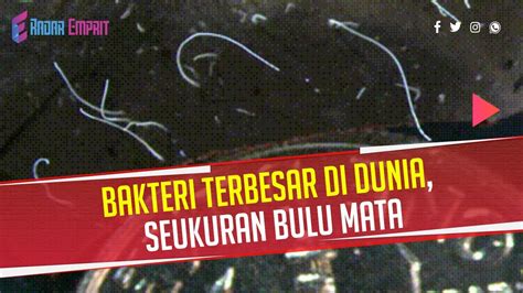 Viral Ditemukan Bakteri Terbesar Di Dunia Seukuran Bulu Mata Youtube