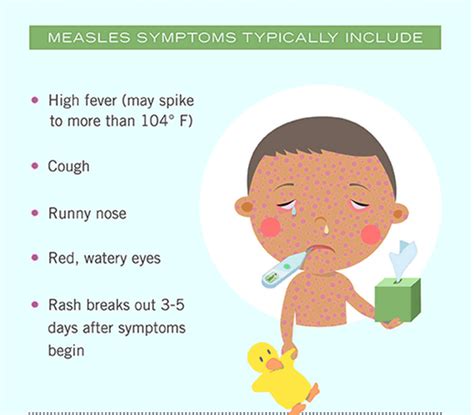 Rubeola Virus Symptoms