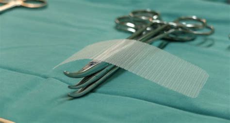 surgical mesh archives goldberg persky white pc
