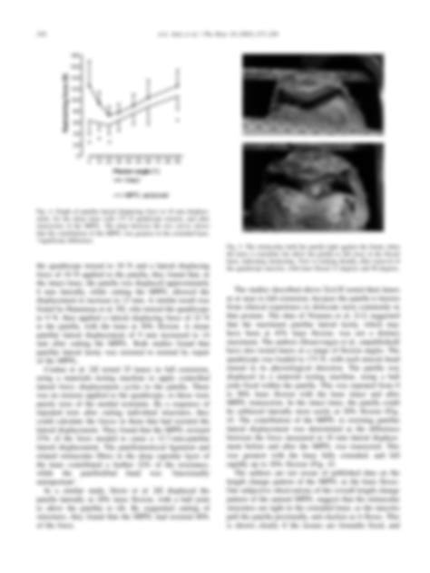 SOLUTION: Anatomy and biomechanics of the medial patellofemoral ...