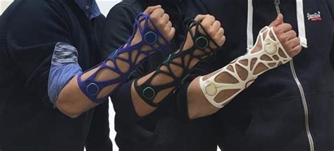 D Printed Orthotics Most Promising Projects In All Dp Atelier