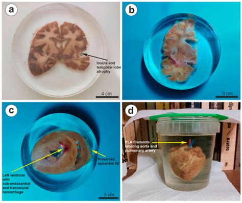 Biomedicines Free Full Text Simple Universal Whole Organ Resin Embedding Protocol For