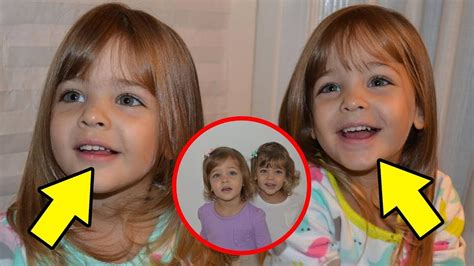 This Couple Gave Birth To The Most Beautiful Pair Of Twins Look Where They Are Now Youtube