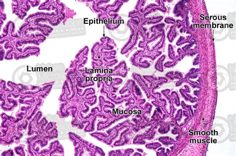 Fallopian Tube Histology Labeled