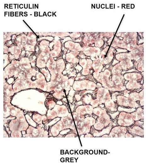 Fibrin Weigert Stain Method