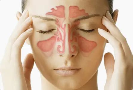 How To Prevent Sinus Headaches? - Body Pain Tips