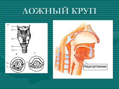 Основные синдромы у детей - презентация онлайн