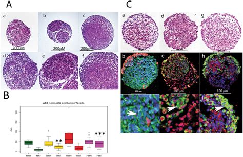 Growth Of Glioblastoma Tumors In The Gbs Model Tumour Cell Growth Was