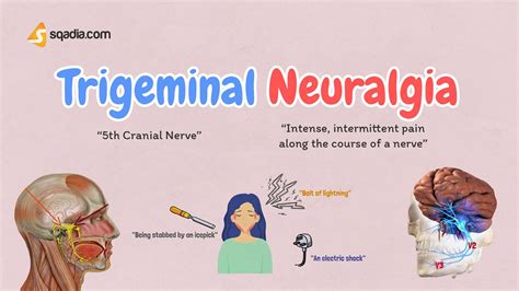 Trigeminal Neuralgia Symptoms Causes Treatment Surgery