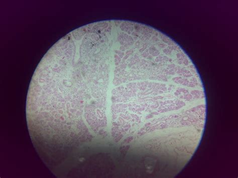 Histoslides Mixed Salivary Gland