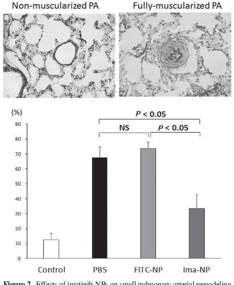 Figure From Delivery Of Imatinib Incorporated Nanoparticles Into