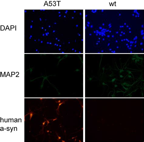 Human A53T α synuclein causes reversible deficits in mitochondrial