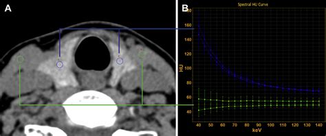 Dual Energy Computed Tomography Neuroimaging Clinics