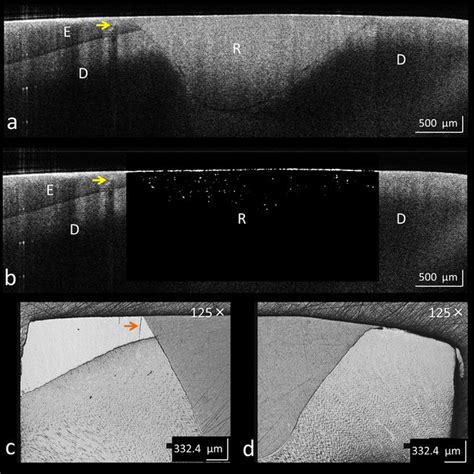 Representative Cross Sectional SS OCT Images And Corresponding CLSM