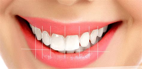 Digital Smile Design Dijident Oral And Dental Health Polyclinic