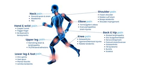 Shockwave Therapy Old Town Lincoln Park Il Chiropractic Chicago