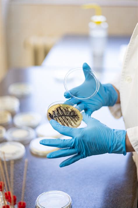 microbiological culture media torlak institute