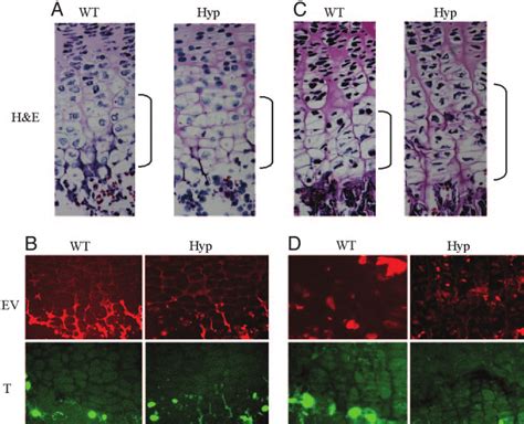 Histological Analysis And Evaluation Of Hypertrophic Chondrocyte