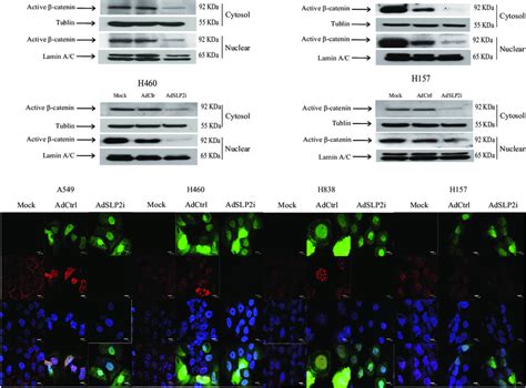 Western Blotting And Immunofluorescence Analysis For The Nuclear Download Scientific Diagram