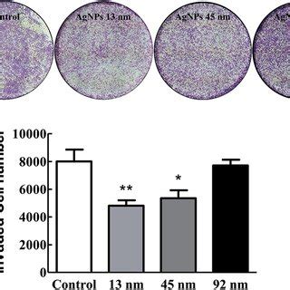 Transwell migration assay. (a) Representative photographs of transwell... | Download Scientific ...