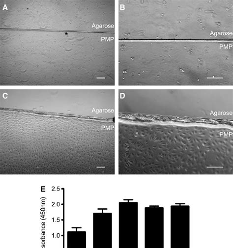 Figure 2 From Reduced Thrombocyte Adhesion To Endothelialized Poly 4