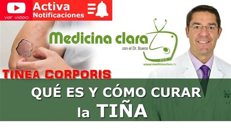 Tiña ¿como Curar La Tiña Síntomas Tratamiento Explicación Medicina Clara Youtube