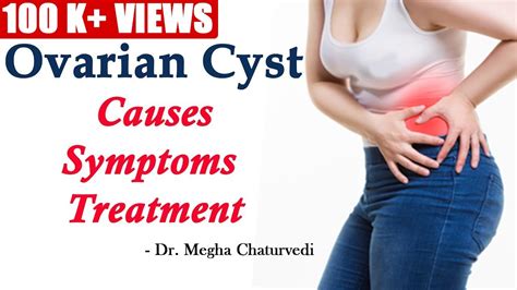 ovarian cyst symptoms - DrBeckmann