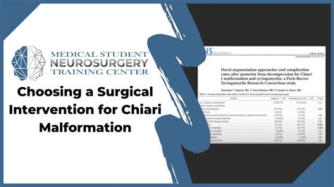 Choosing A Surgical Intervention For Chiari Malformation Youtube