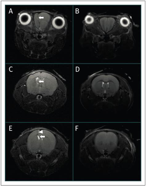 Sequential T2 Weighted T2w Transverse Magnetic Resonance Images Download Scientific Diagram