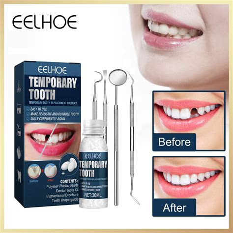 Eelhoe Temporary Tooth Repair Kit Filling Teeth And Gaps False Teeth