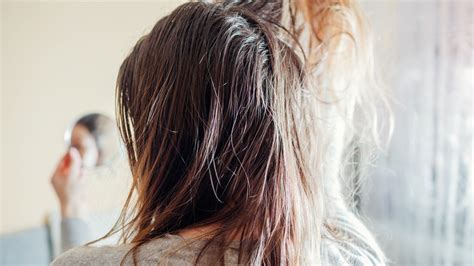 Greasy Hair 10 Ways To Treat And Prevent It According To Experts