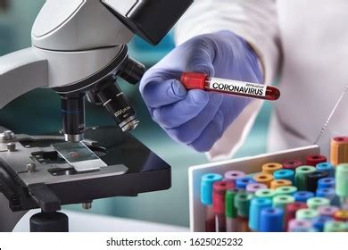 Microbiologist Tube Biological Sample Contaminated By Stock Photo Edit