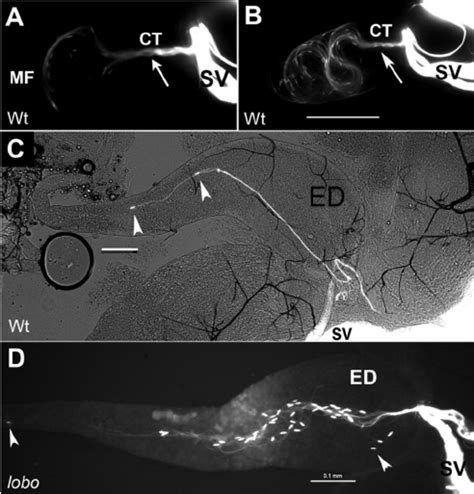 Movement of sperm from the SV into the ED in the male. The sperm heads ... 