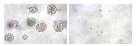 Cytoselect 96 Well In Vitro Tumor Sensitivity Assay Soft Agar Colony Formation Assay Kit