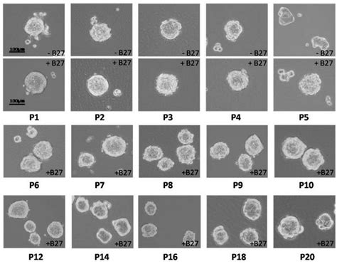 Optical microscopy for tumorspheres from serial cultivation in the ...