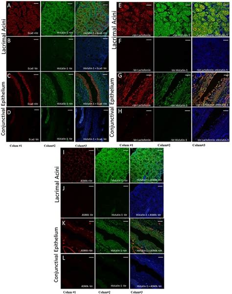 Smooth Muscle Actin Antibody Monoclonal 1a4 Asm 1