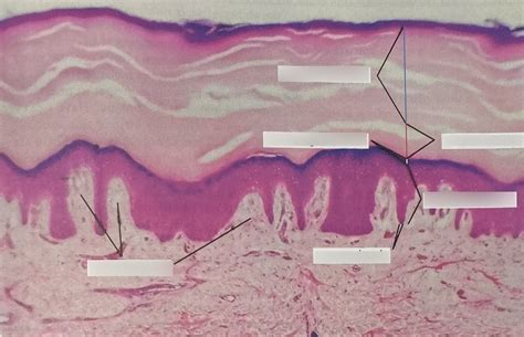 Diagram of the Epidermis Diagram | Quizlet