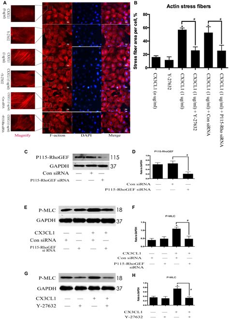 Frontiers Cx Cl Induces Vertebral Microvascular Barrier Dysfunction