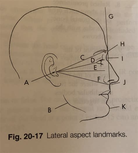 Lateral Aspect Landmarks Diagram Quizlet