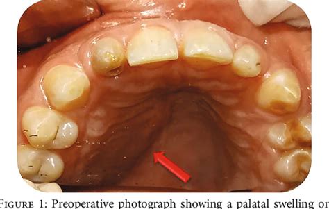 Figure 2 From CBCT Evaluation And Conservative Management Of A Large