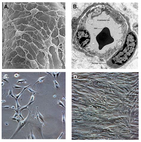 Ijms Free Full Text Human Vascular Pericytes And Cytomegalovirus