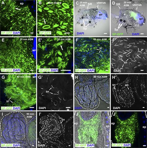 SP GFP Is Loaded On Microcarriers Which Disassemble When Transferred