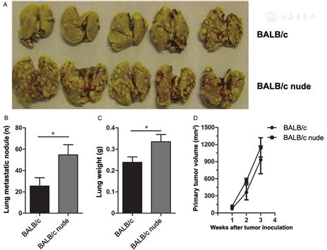 Interferon Gamma Inhibits Aldehyde Dehydrogenasebright Cancer Stem