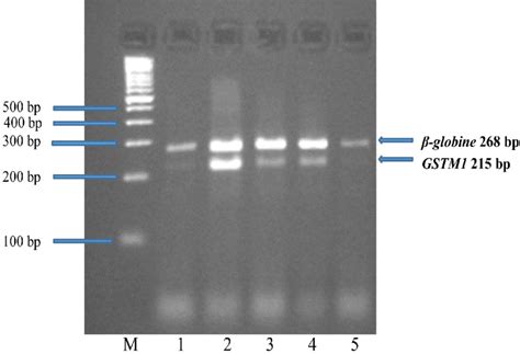 Pcr Multiplex Electrophoresis Gel Legend M Molecular Weight Marker Download Scientific