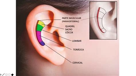 Cha Marquesina Le N Acupuntura Auricular Pontos Na Orelha Y Equipo