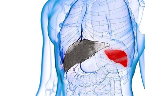 Spleen Enlarged Size Enlarged Spleen Causes Symptoms And Treatment