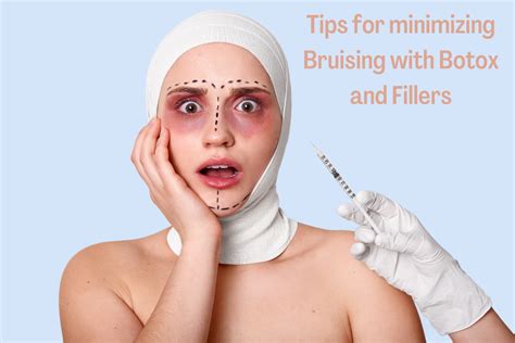 10 Tips On How To Prevent Bruising With Botox And Fillers