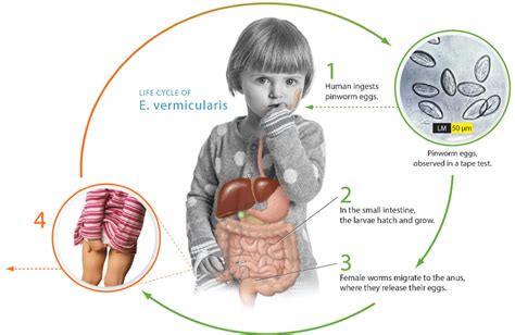 Pinworm Life Cycle